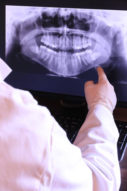 Best Emergency Wisdom Tooth Extraction in Pigeon Forge, TN