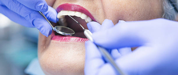 Best Knocked-Out Tooth (Avulsed Tooth) Treatment in Pigeon Forge, TN